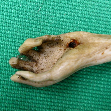 Scultura in avorio raffigurante Cristo crocifisso, fase del processo di restauro. - Ivory sculpture representing Christ crucified, step of restoration